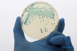 Dampak serius Bakteri E.coli lebih dari sekadar diare