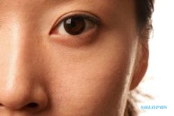 Warna mata orang Indonesia lebih tak tahan cahaya