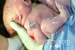   Wanita berbobot 240 Kg lahirkan bayi 6 Kg tanpa operasi