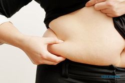 HASIL PENELITIAN : Waduh, Obesitas Bisa Pangkas Kehidupan Sehat hingga 19 Tahun