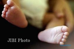 KISAH TRAGIS : Terlahir dengan Kelainan Genetik, Bayi Ini "Dibuang" Ibunya