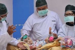 BAYI KEMBAR SIAM : Operasi Pemisahan Berhasil, Rahma-Rahmi Membaik