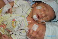 BAYI BERKEPALA DUA : Kondisi Bayi Menurun, Tim Dokter Rapat