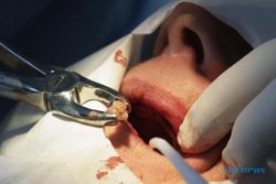 PENEMUAN BARU : Gunakan Laser, Ilmuan Tumbuhkan Gigi 