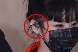 K-POP : Telinga Diplester, Netizen Curigai Bom 2Ne1 Operasi Plastik 