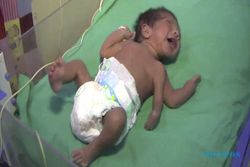 KISAH UNIK : Bayi Ini Memiliki Tiga Tangan Saat Lahir