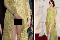 PIALA OSCAR 2015 : Pakai Belahan Gaun Tinggi, CD Emma Stone Ngintip