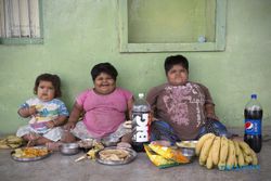KISAH UNIK : 3 Anak Obesitas, Ayah Siap Jual Ginjal
