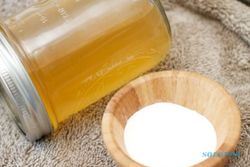 TIPS KECANTIKAN : Bersihkan Ketombe dengan Baking Soda dan Cuka Apel