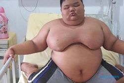 Bocah Obesitas Asal Palembang Koma