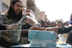 KISAH TRAGIS : Tolak Perintah ISIS, Tangan Dua Bocah Ini Dipotong di Depan Umum