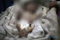 Kisah Tragis di Balik Foto Bayi Suriah yang Mati Kelaparan