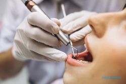 Ingin Perawatan Gigi Pakai BPJS? Ketahui Daftar dan Prosedurnya