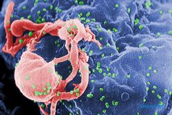 Top Markotop, Pasien HIV London Dinyatakan Sembuh
