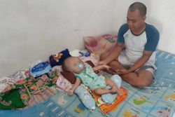 Hiks... Keluarga Bayi Hidrosefalus di Madiun Tak Dapat Bansos Meski Terdampak Covid-19