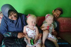 Cerita Warga Wonogiri Punya Anak Kembar Albino, Mau Pingsan Saat Lahiran
