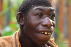Dibully Gara-Gara Berbeda, Pria Ini Diajak Ibunya Hidup di Hutan