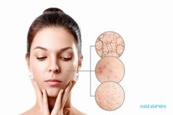 Punya Masalah dengan Skin Barrier, Perbaiki Dengan Cara Ini