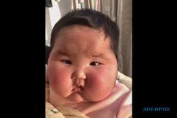 Bayi Ini Membengkak Dua Kali Lipat Setelah Diolesi Krim Steroid