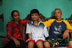 Kisah Pilu Alfian Pelajar SMK Klaten, 2 Tangannya Diamputasi Gara-Gara Kecelakaan Saat PKL