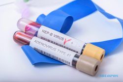 Antisipasi Hepatitis Akut, Disdikbud Wonogiri Tekankan Prokes dan PHBS