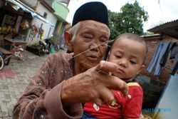 Dianggap Kutukan atau Guna-Guna, Kasus Kusta di Indonesia Terbesar Ketiga Dunia