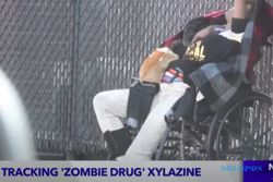 Viral Narkoba yang Ubah Pengguna Jadi ‘Zombie’ di AS, Kulit & Daging Membusuk