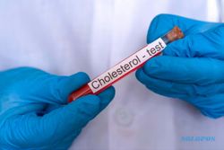 Benarkah Kolesterol Tinggi dalam Tubuh Timbulkan Rasa Lelah? Ini Ulasannya
