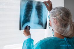 Apa Itu Pneumonia? Kenali Penyebab dan Gejalanya