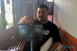 Kadinkes Ngawi Bantah Tudingan Suami Korban Meninggal Usai Cabut Gigi Bungsu